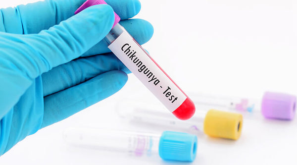 symptoms and treatment for chikungunya