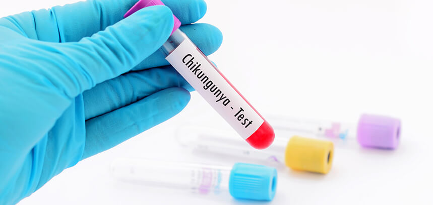 symptoms and treatment for chikungunya